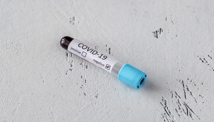 Koronavirusa qarşı yapon dərmanı arbidoldan daha təsirlidir