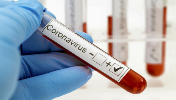 В Азербайджане выявлено еще 110 случаев заражения коронавирусом, 127 человек вылечились, 1 скончался