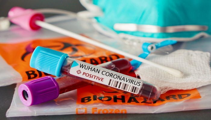 В Азербайджане 141 новый случай заражения коронавирусом