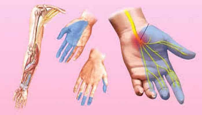 Почему немеют руки: 7 серьезных причин 