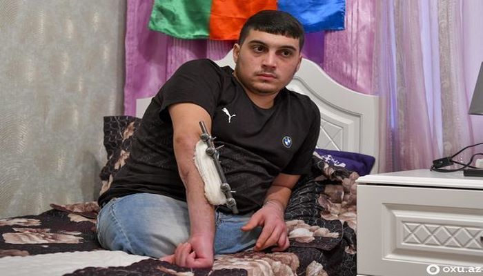 Ayaqlarını itirən 20 yaşlı Qarabağ qazisi üçün protez hazırlıqlarına başlanıldı - RƏSMİ