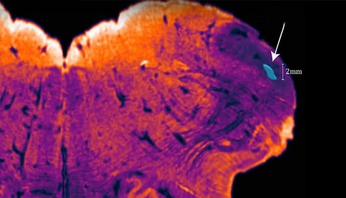 Обнаружен ранее неизвестный участок мозга
