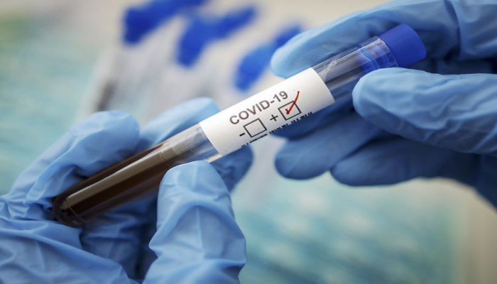 В США рассчитывают получить вакцину от коронавируса до конца года