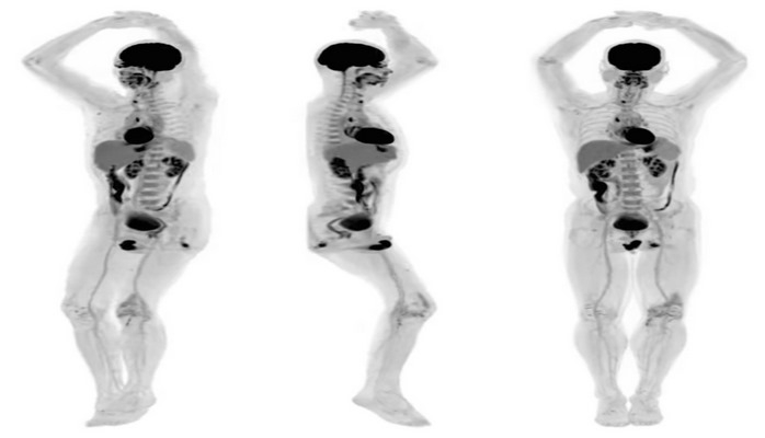 Первый в мире сканер для всего тела: как это работает