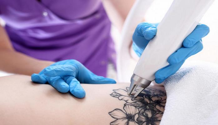 Как сводят татуировки и чем это опасно